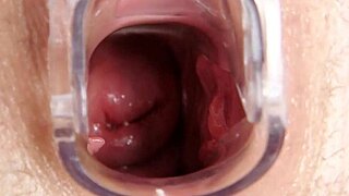 사라와 의료 페티시 검사, 가까운 감시 하에