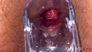 anal vision with speculum on tight mature slut