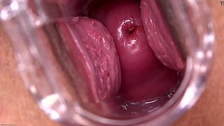 Mia Austin With A SPECULUM Close Up